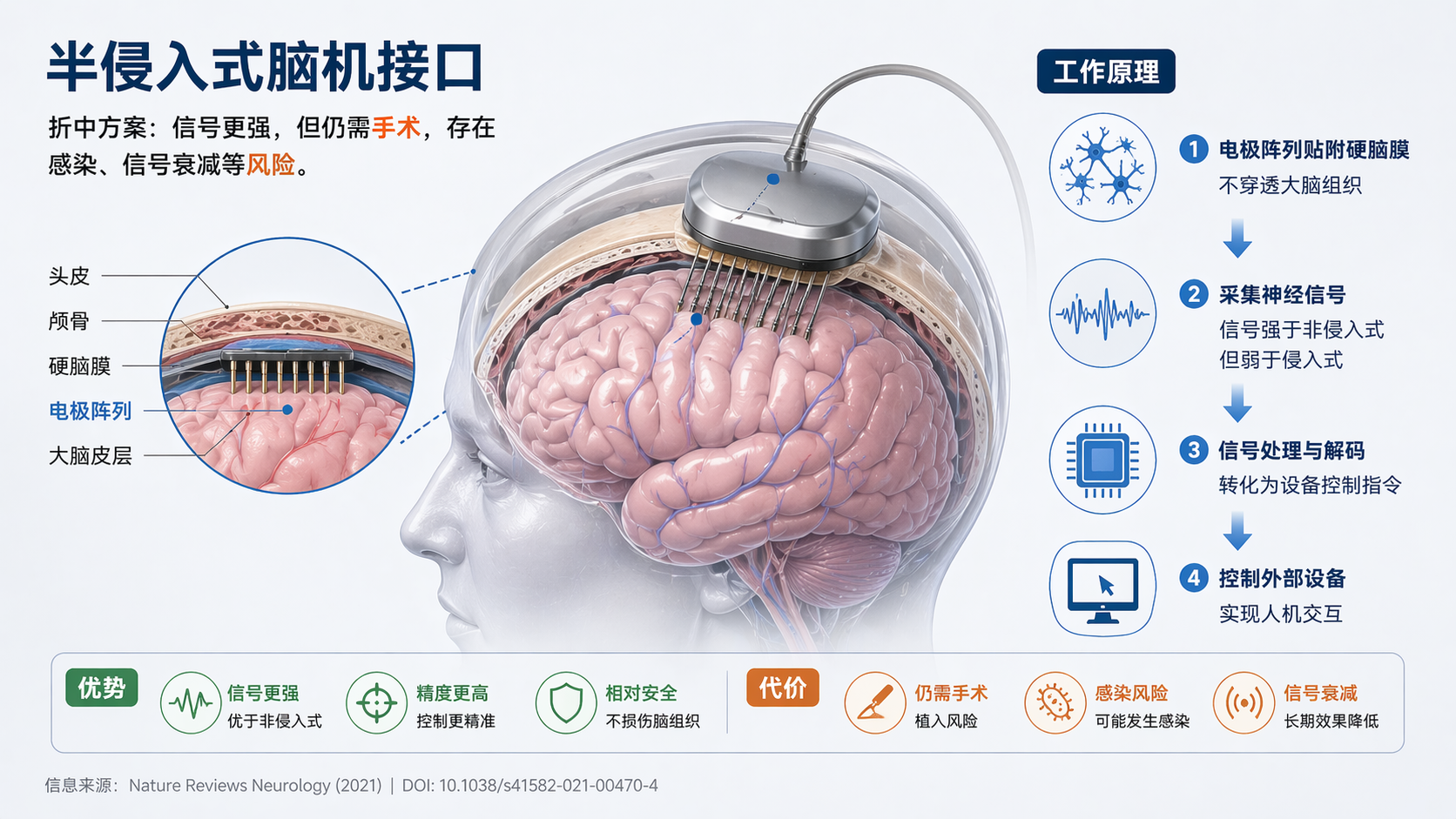 半侵入式脑机接口原理图